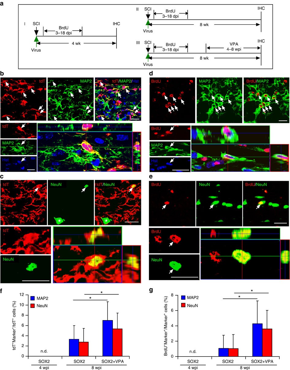 Figure 8: Maturation of SOX2-induced new neurons in the injured adult spinal cord.