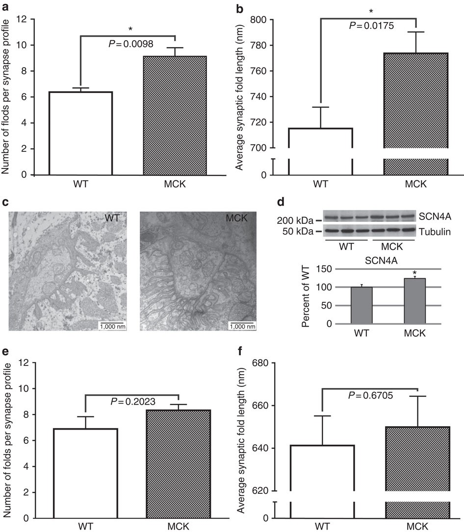 Figure 3: Synaptic fold characterization on the TEM images from WT and transgenic mice NMJs.