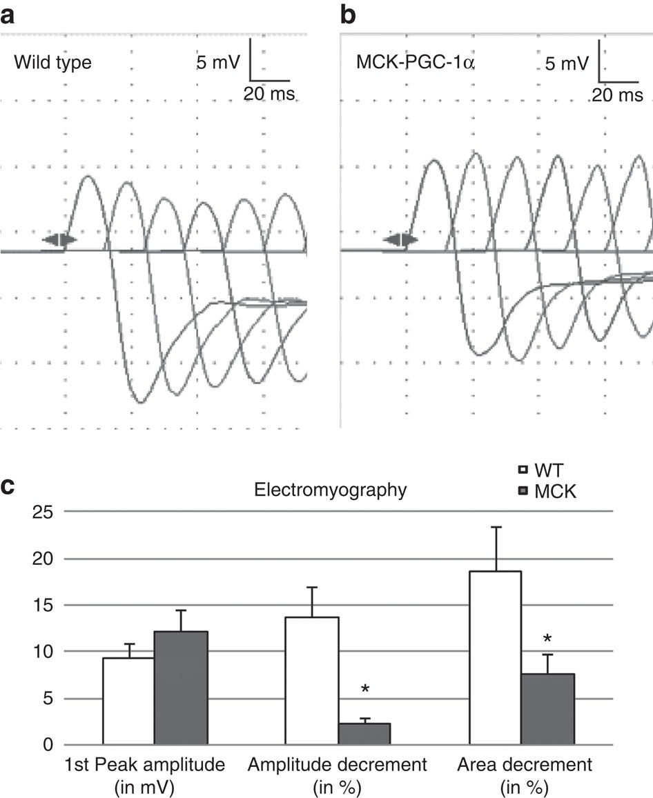 Figure 4: Electromyographic properties of the gastrocnemius muscles in WT and MCK mice after repetitive nerve stimulation of the sciatic nerve.