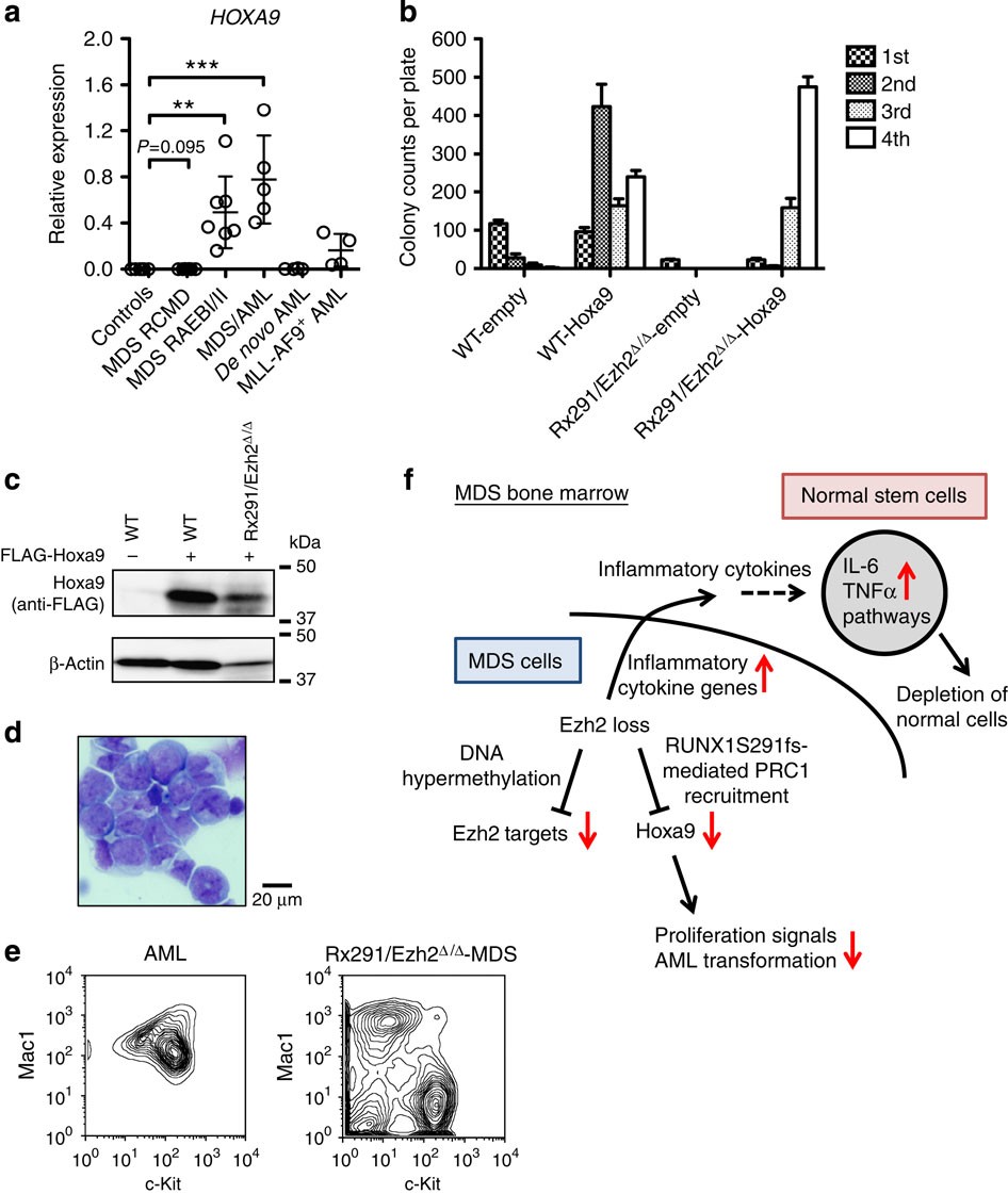 Figure 7: Hoxa9 expression level is critical for transformation from MDS to AML.