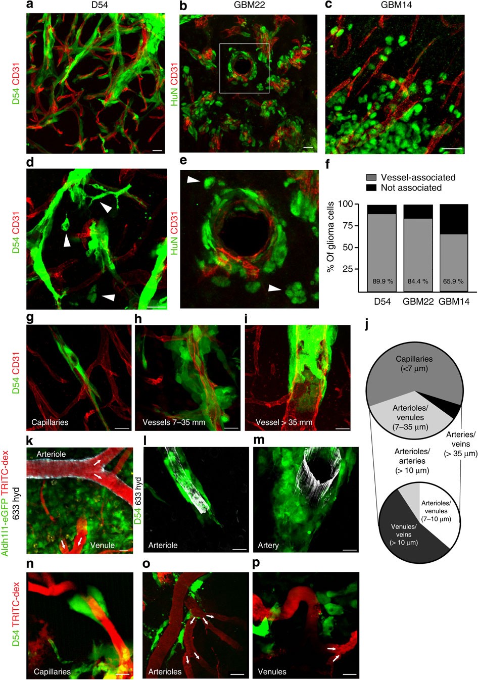 Disruption of astrocyte–vascular coupling and the blood–brain barrier by  invading glioma cells | Nature Communications