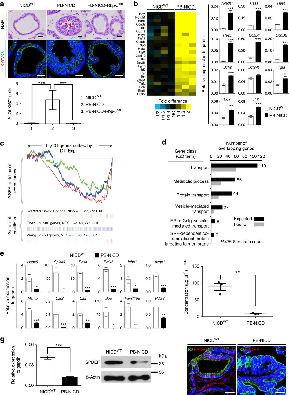 Increased Notch signalling inhibits anoikis and stimulates proliferation of prostate luminal epithelial cells | Nature Communications increased-notch-signalling-inhibits-anoikis-and-stimulates-proliferation-of-prostate-luminal-epithelial-cells-nature-communications
