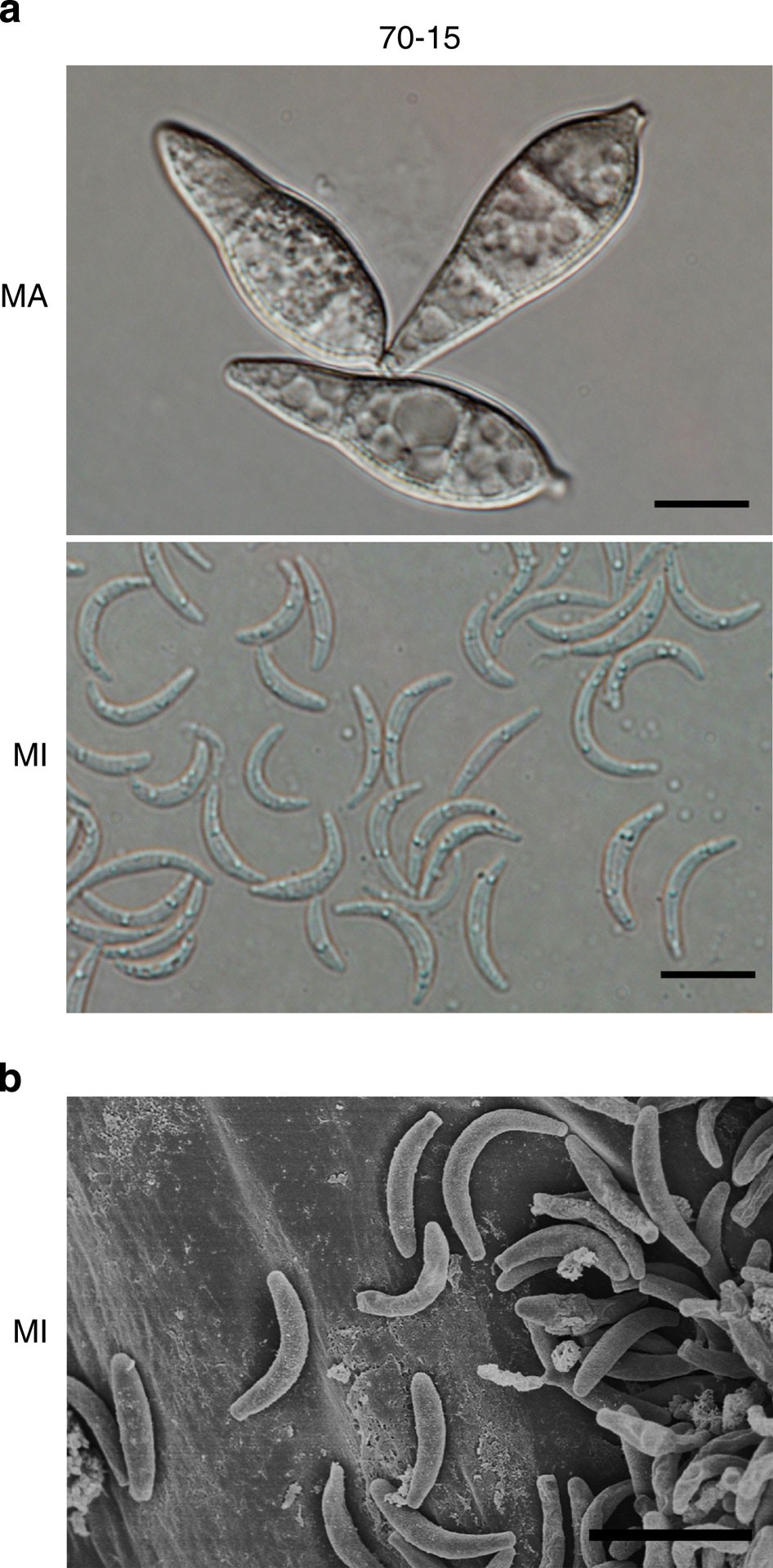 Germination and infectivity of microconidia in the rice blast fungus Magnaporthe  oryzae | Nature Communications