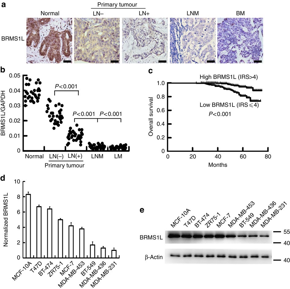 BRMS1L suppresses breast cancer metastasis by inducing epigenetic silence  of FZD10 | Nature Communications