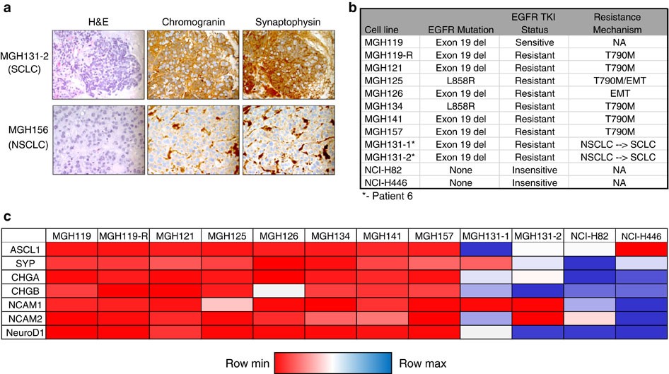 RB loss in resistant EGFR mutant lung adenocarcinomas that transform to  small-cell lung cancer | Nature Communications