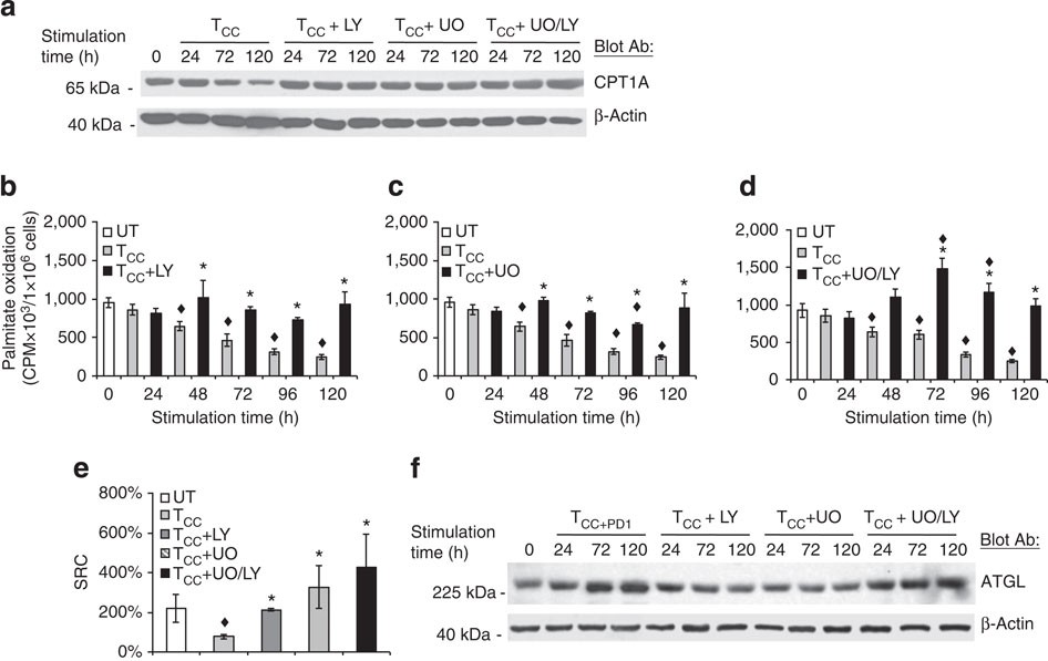 Figure 6: Inhibition of PI3K/Akt and MEK/Erk pathways is involved in the metabolic reprogramming of activated T cells.