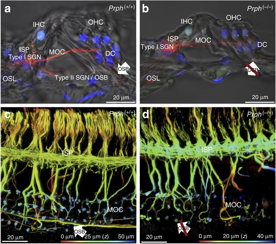 Type II spiral ganglion afferent neurons drive medial olivocochlear reflex  suppression of the cochlear amplifier | Nature Communications