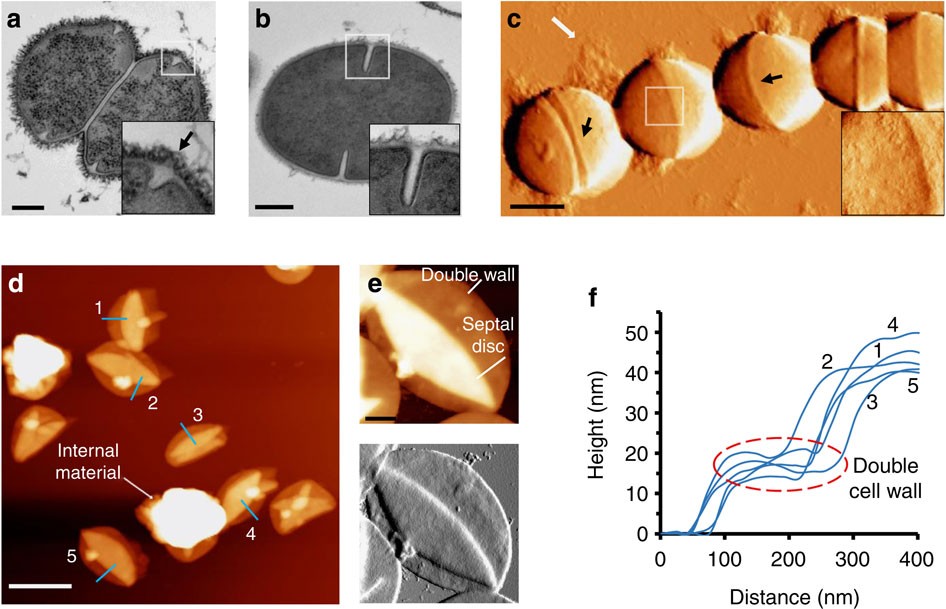 Group A Streptococcus in Japan Spring 2024 Buzzing Bacteria