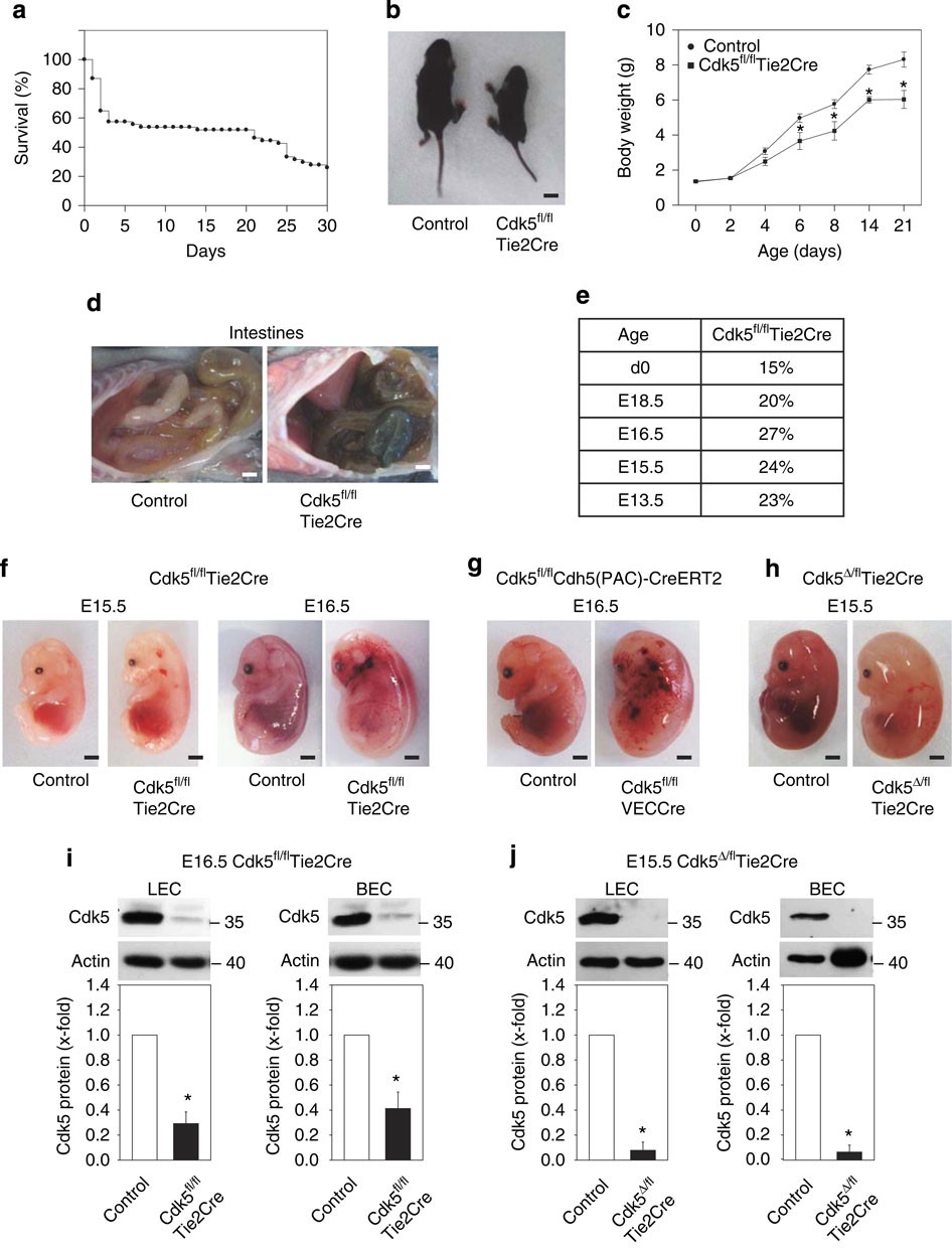 Cdk5 controls lymphatic vessel development and function by phosphorylation  of Foxc2 | Nature Communications