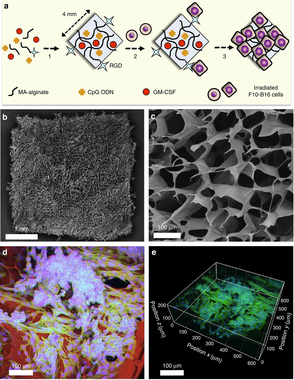 Biodegradable gel boosts immune system's attack on several cancers in mice