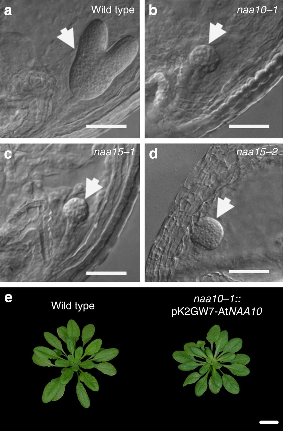 Downregulation of N-terminal acetylation triggers ABA-mediated drought  responses in Arabidopsis | Nature Communications
