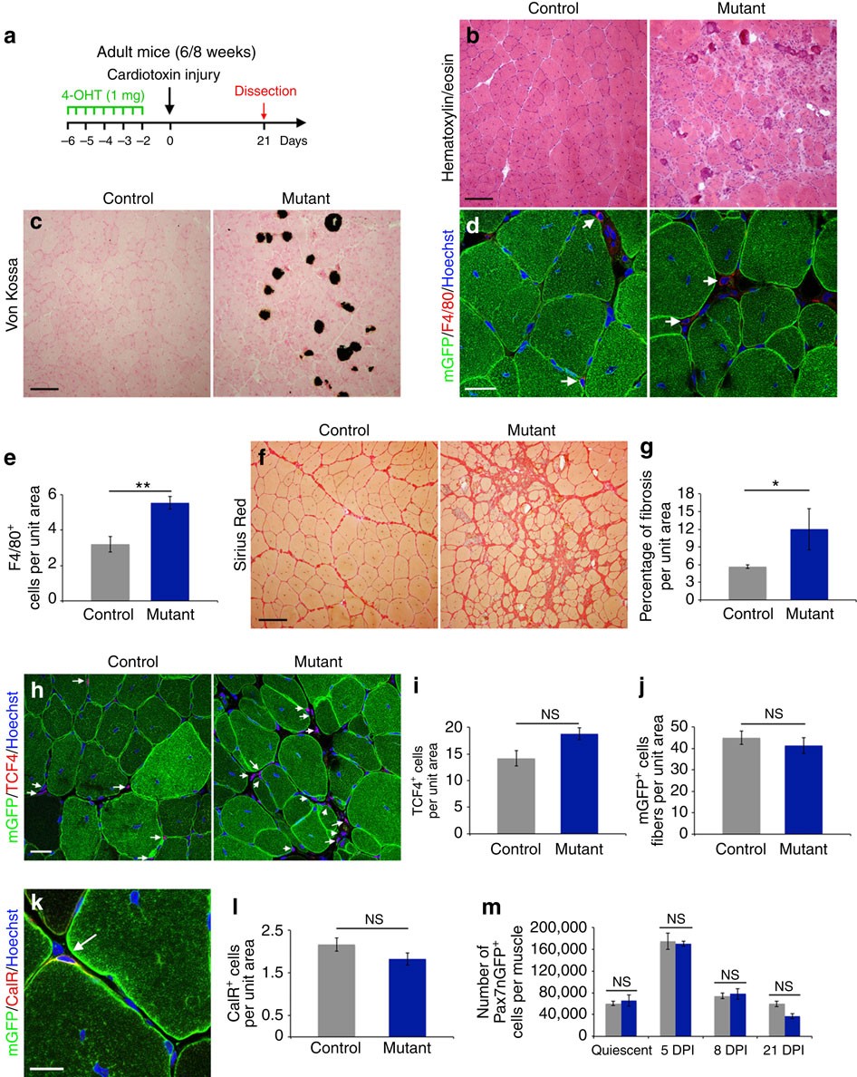 Numb is required to prevent p53-dependent senescence following skeletal  muscle injury | Nature Communications