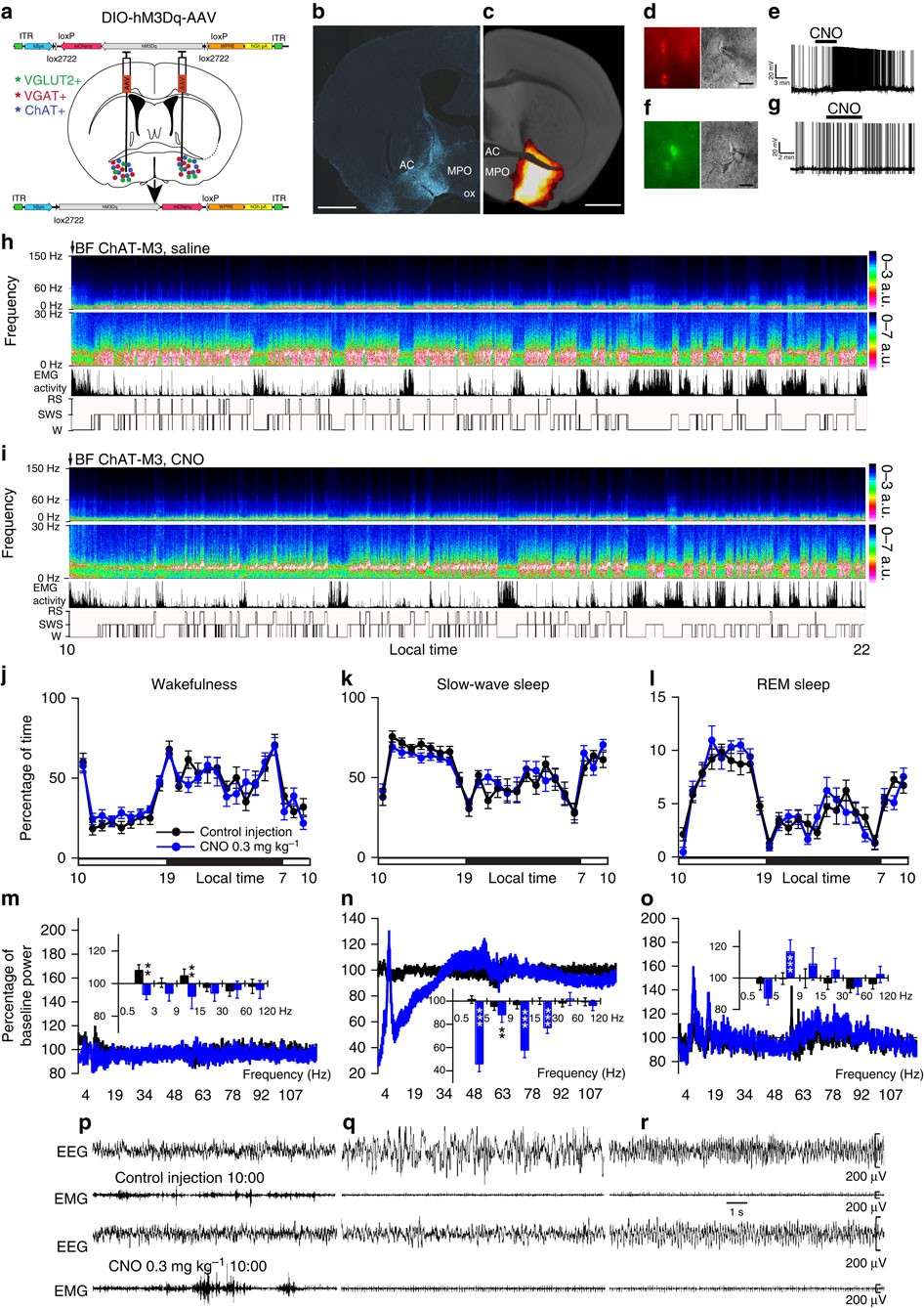 Basal forebrain control of wakefulness and cortical rhythms | Nature  Communications