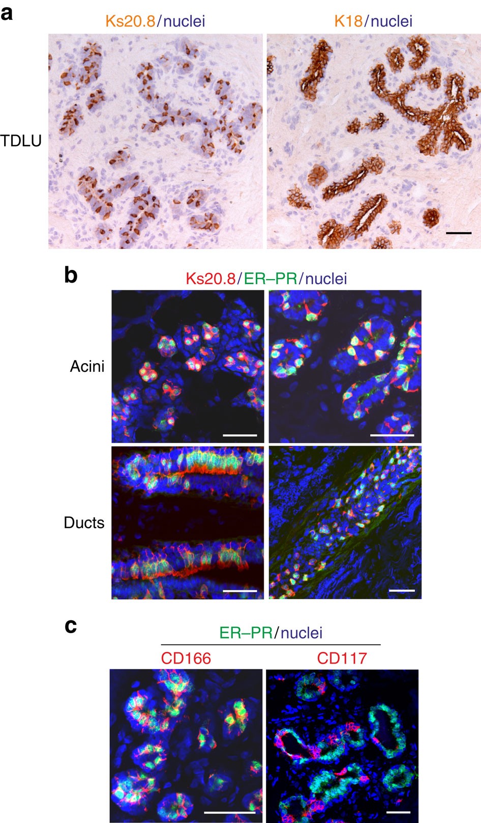 Estrogen receptor α contributes to T cell–mediated autoimmune inflammation  by promoting T cell activation and proliferation | Science Signaling, image size:946x1616