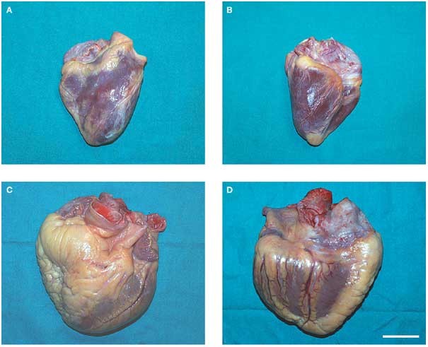 Epicardial adipose tissue: anatomic, biomolecular and clinical  relationships with the heart | Nature Reviews Cardiology