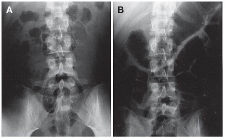 bpc 157 ulcerative colitis reddit Frontiers main image 1
