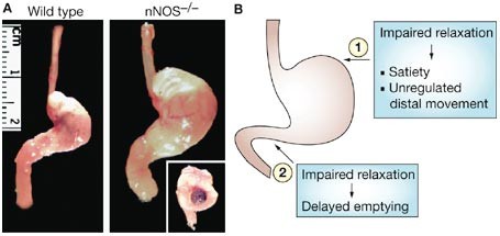 Impairment of the antral receptive relaxation in diabetic gastroparesis