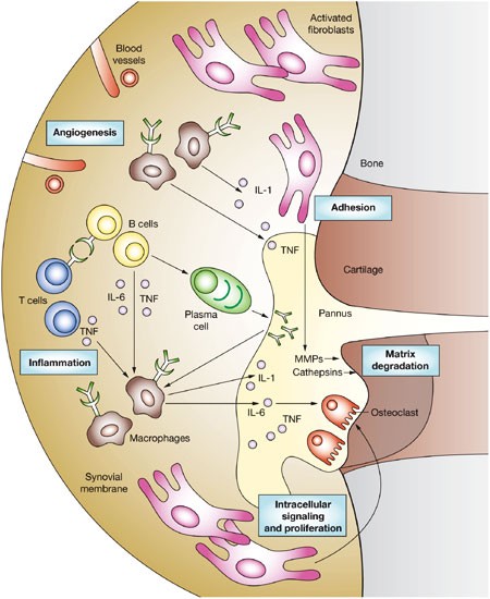 diffúz kötőszöveti betegségek patogenezise a myron sp térdízületének kötéseinek károsodása