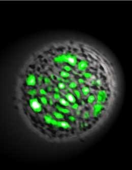 Human cell becomes living laser | Nature