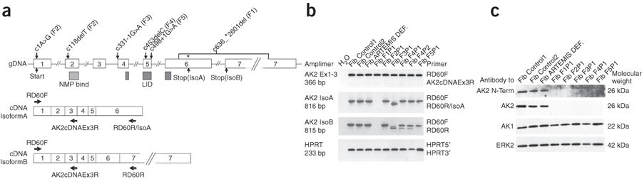 Reticular dysgenesis (aleukocytosis) is caused by mutations in the gene  encoding mitochondrial adenylate kinase 2 | Nature Genetics