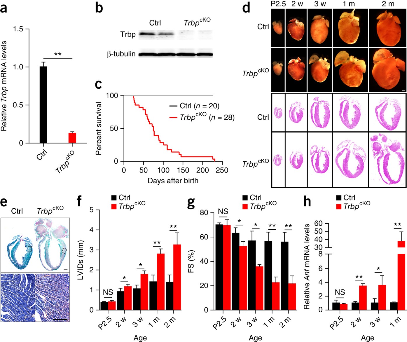 Trbp regulates heart function through microRNA-mediated Sox6 repression |  Nature Genetics