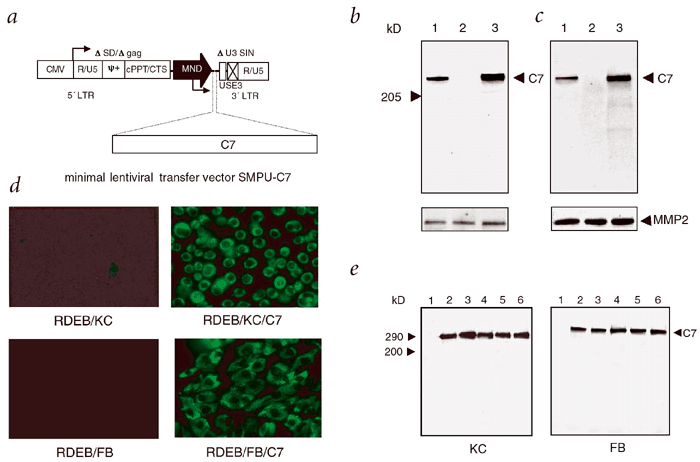 Human skin reconstitution in the cell-sorted skin equivalent (CeSSE)