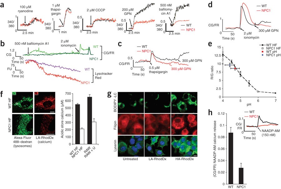 A proposed model for the pathogenesis of Niemann-Pick disease type