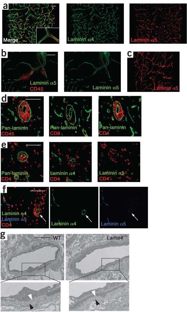 Endothelial Basement Membrane Laminin α5 Selectively - 