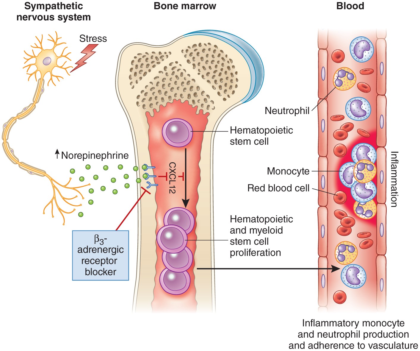 Stressing Out Stem Cells Linking Stress And Hematopoiesis In Cardiovascular Disease Nature Medicine