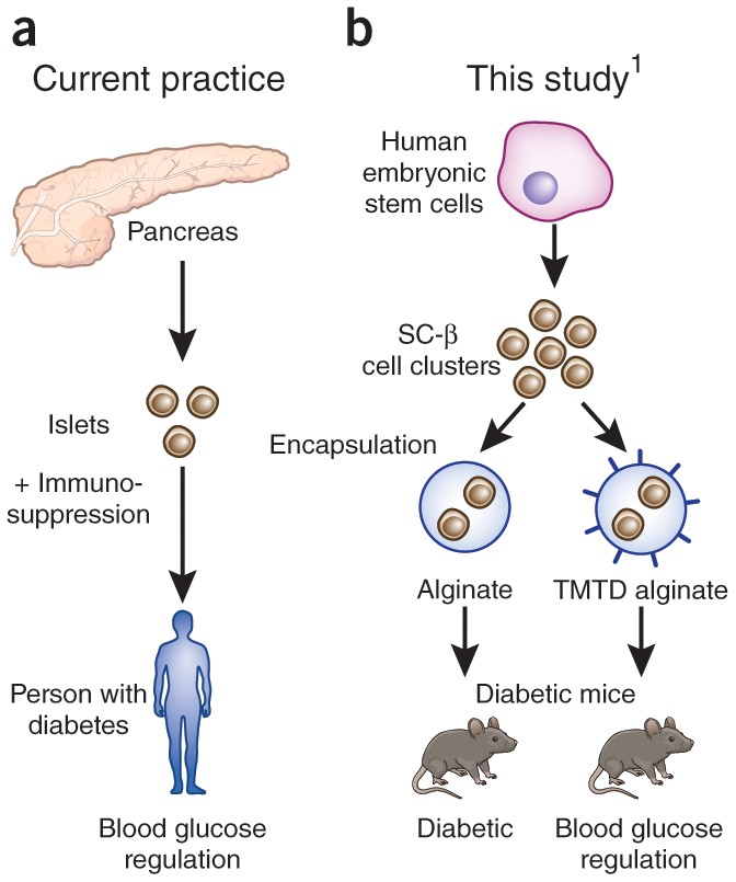 Approaching a cure for type 1 diabetes | Nature Medicine