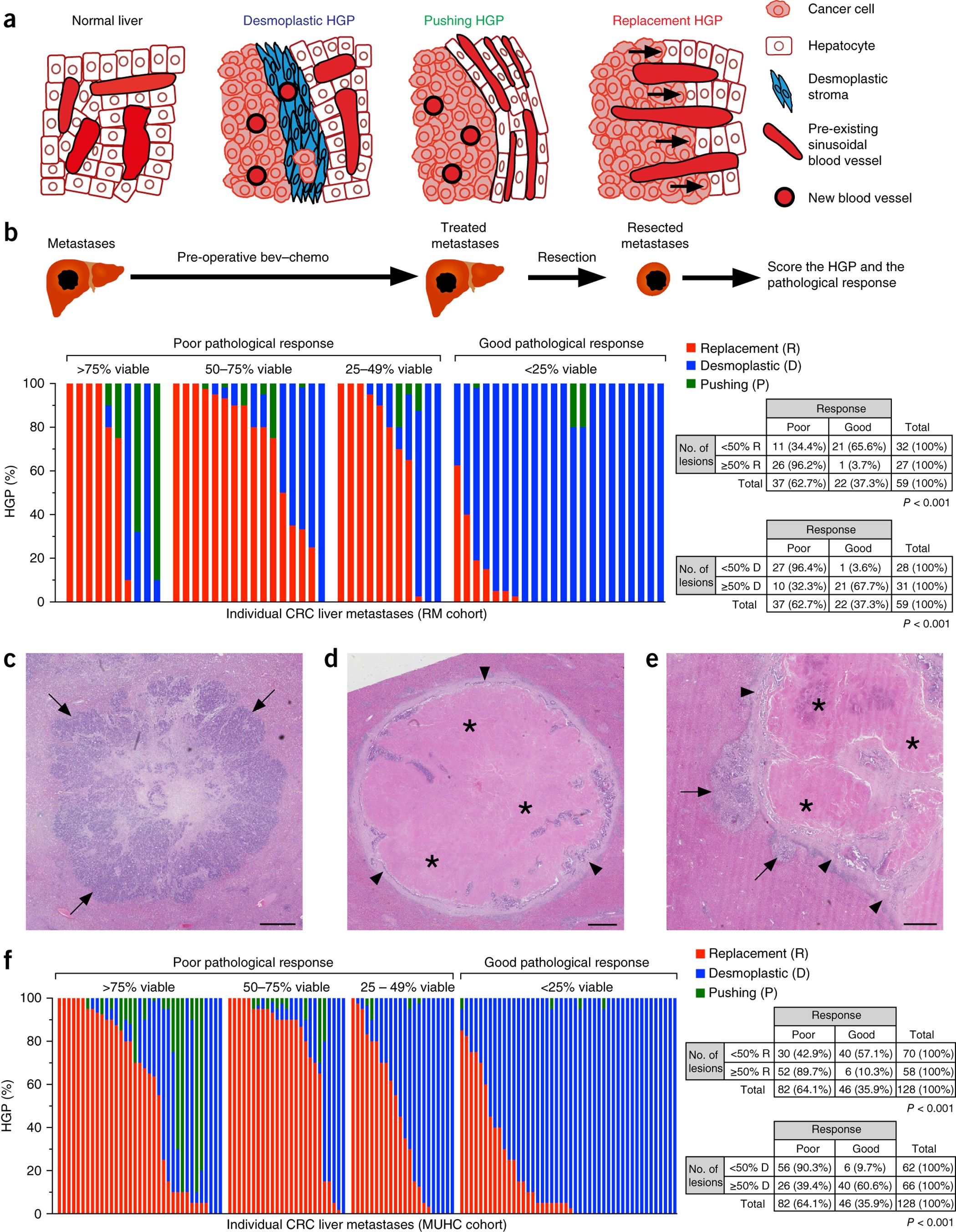 Vessel co-option mediates resistance to anti-angiogenic therapy in liver  metastases | Nature Medicine