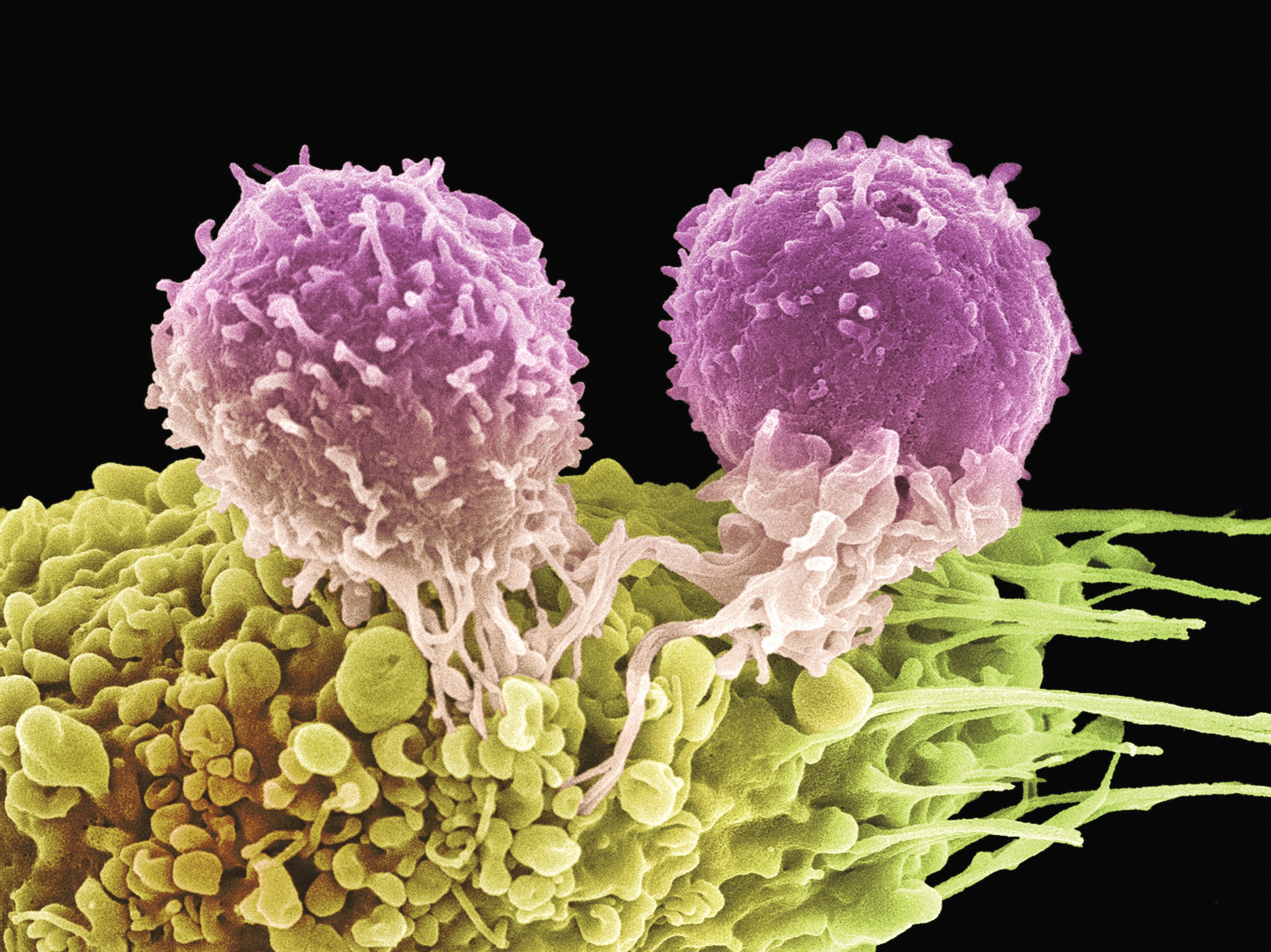Как выглядят лимфоциты под микроскопом Uncovering cancer: How enlisting T cells can boost the power of immunotherapy Na