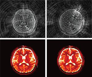 Fingerprinting with MRI | Nature Methods