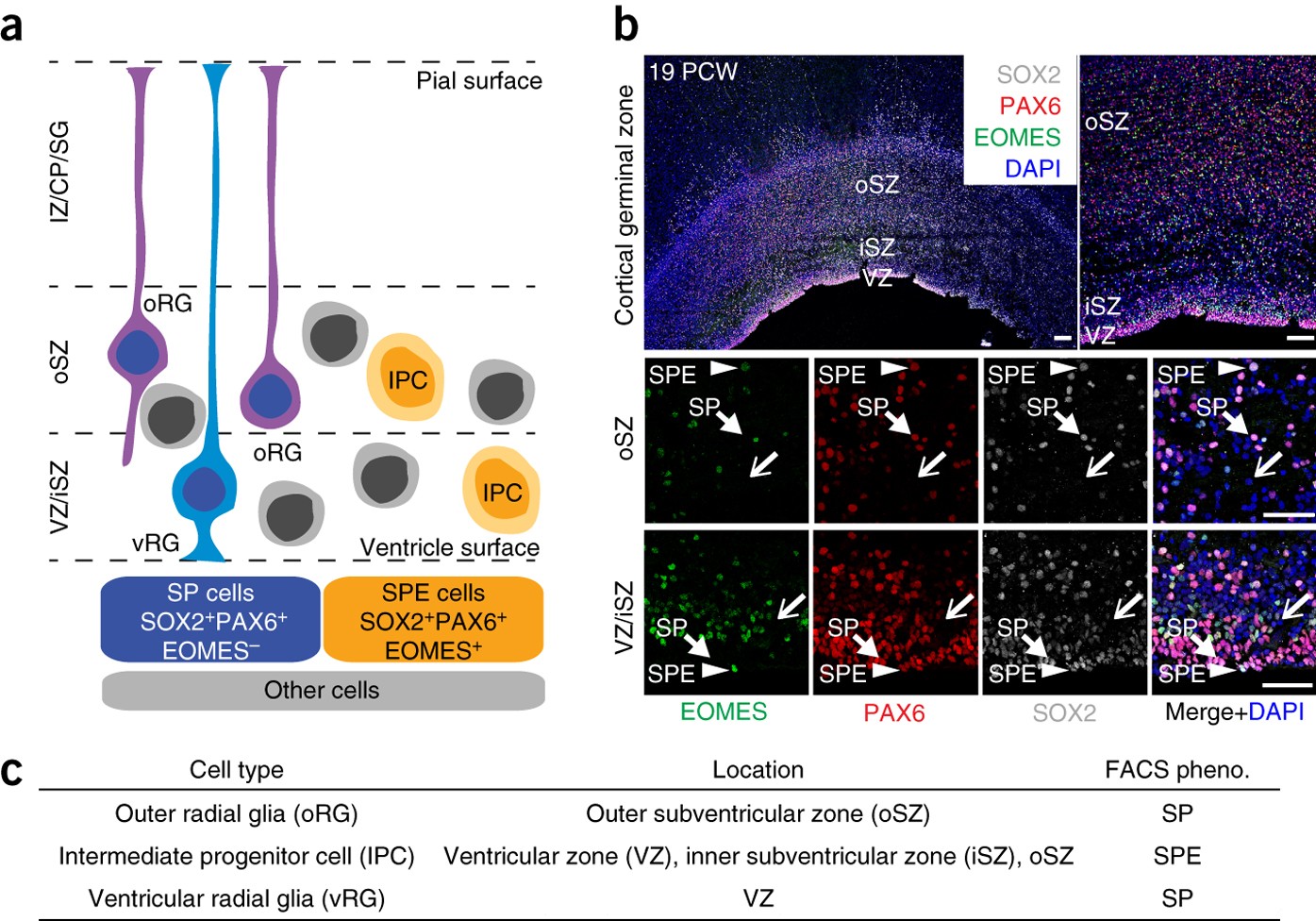 Fixed Single Cell Transcriptomic Characterization Of Human Radial Glial Diversity Nature Methods
