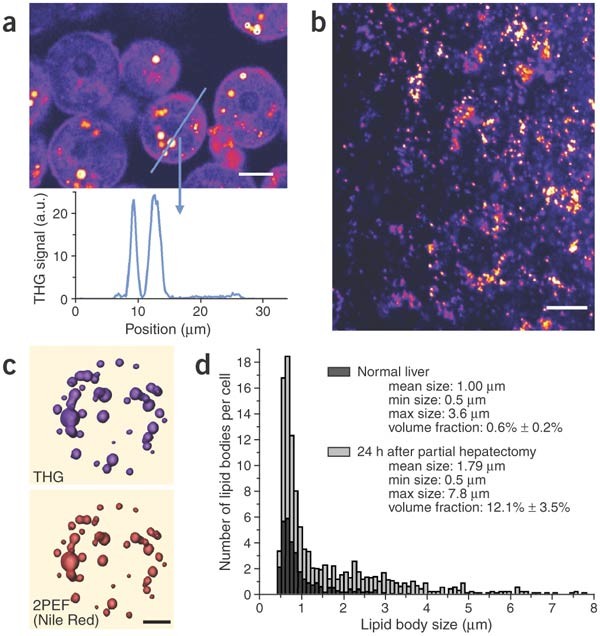 Imaging lipid bodies in cells and tissues using third-harmonic generation  microscopy | Nature Methods