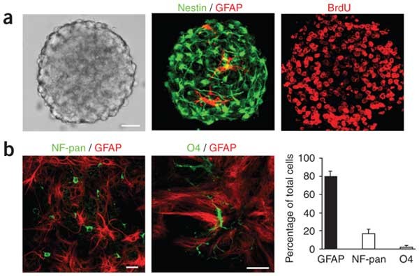 Нейросферы в разных стадиях роста под микроскопом 🔬