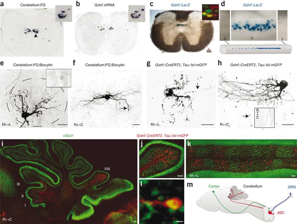 Clarke's column neurons as the focus of a corticospinal corollary circuit |  Nature Neuroscience
