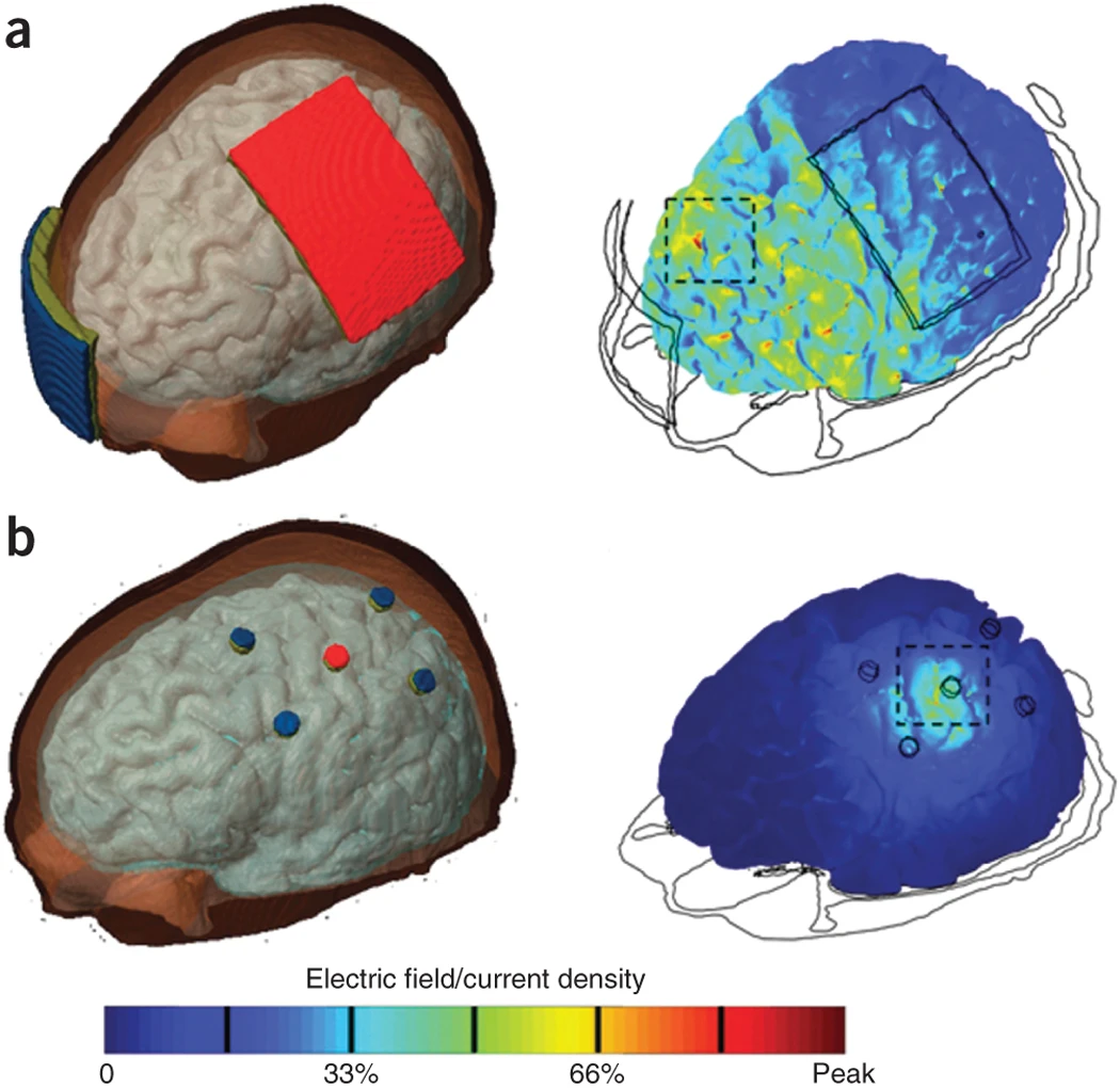 [[@Dayan2013-gp]](http://www.nature.com/neuro/journal/v16/n7/full/nn.3422.html)