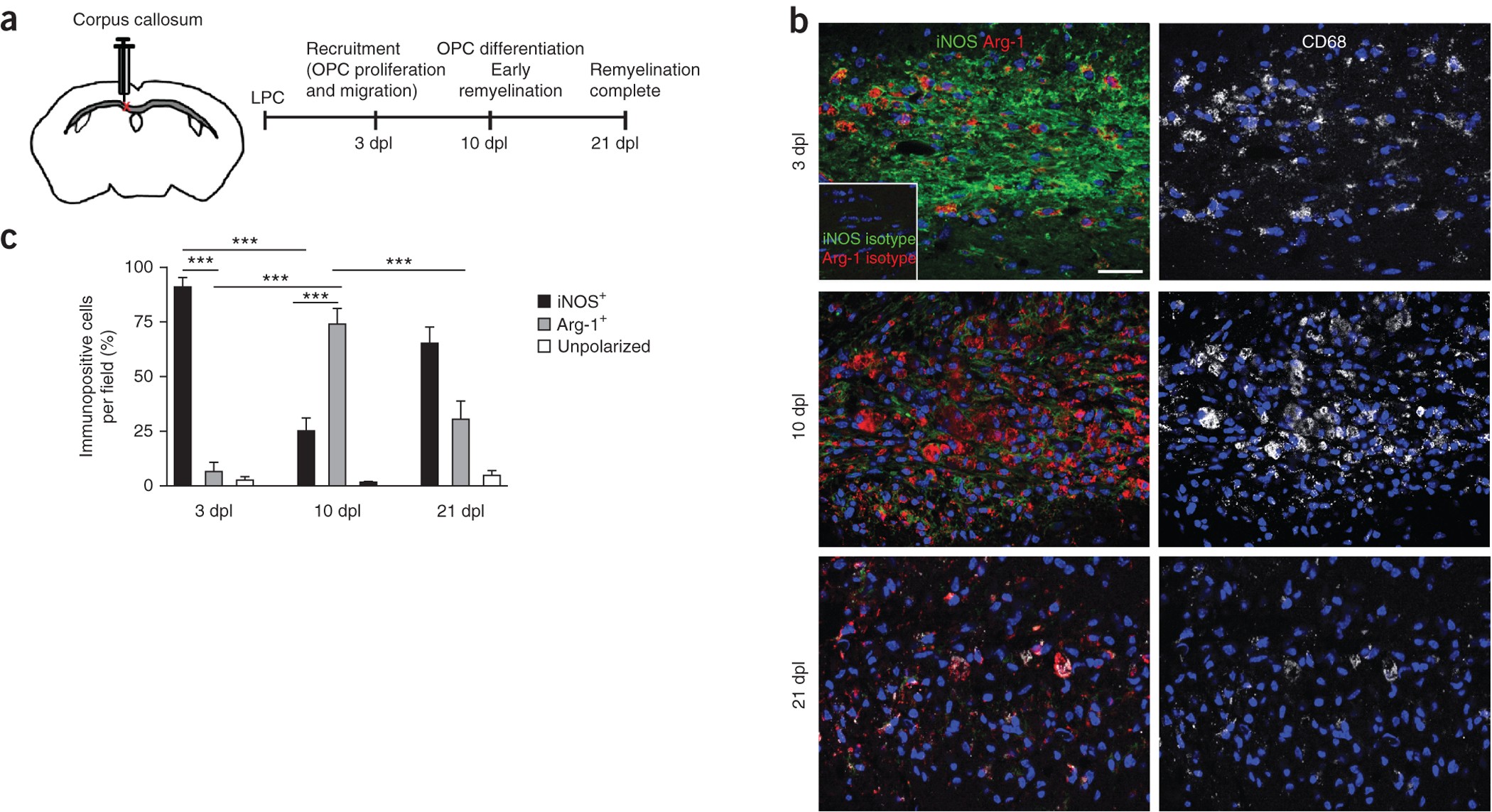 M2 microglia and macrophages drive oligodendrocyte differentiation during  CNS remyelination | Nature Neuroscience