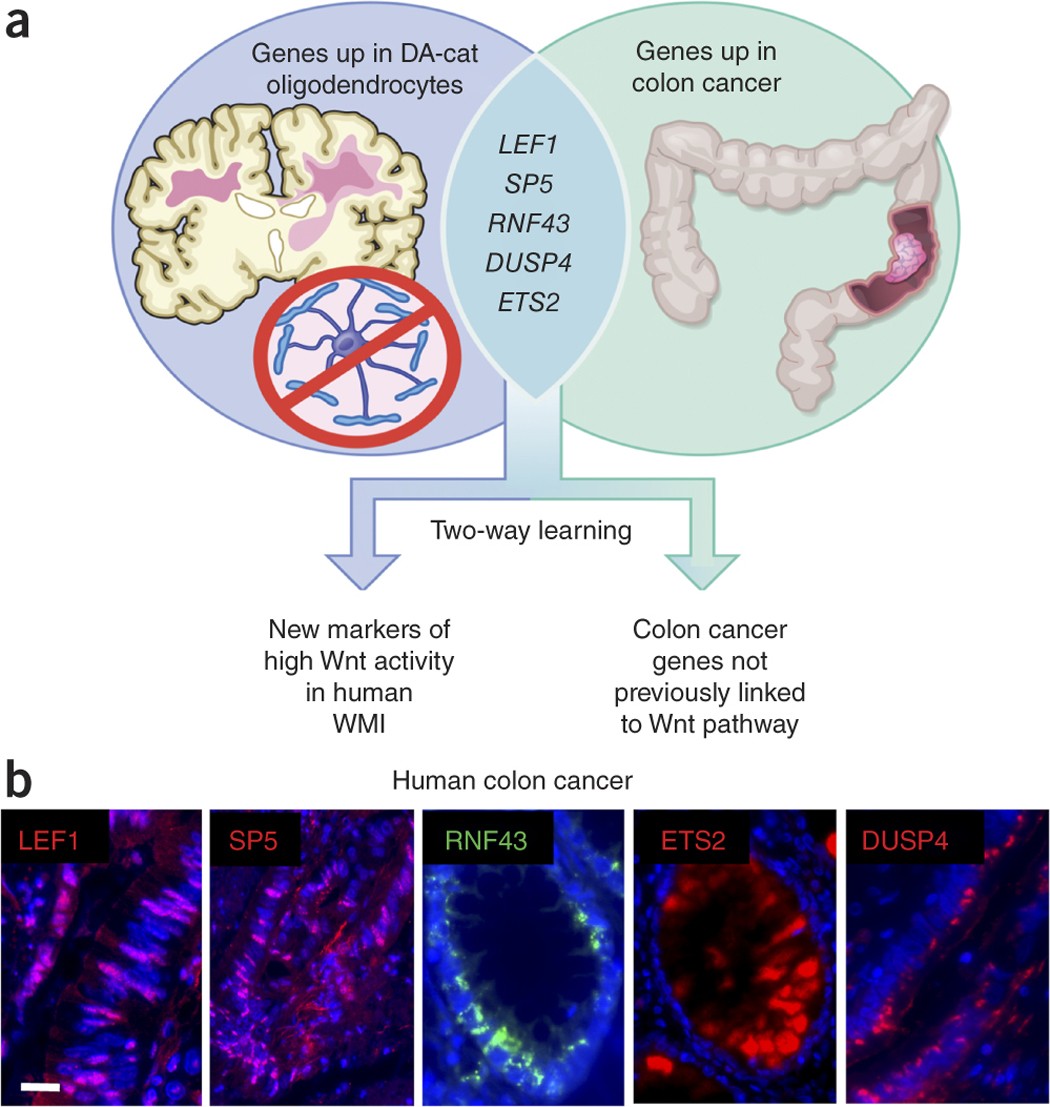 Parallel states of pathological Wnt signaling in neonatal brain injury and colon cancer | Nature Neuroscience parallel-states-of-pathological-wnt-signaling-in-neonatal-brain-injury-and-colon-cancer-nature-neuroscience
