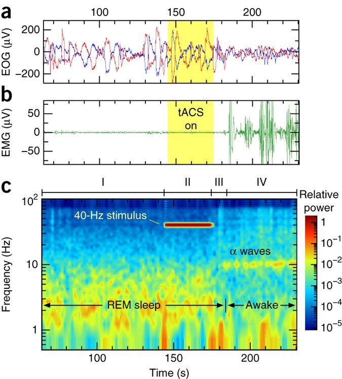 Induction Of Self Awareness In Dreams Through Frontal Low Current Stimulation Of Gamma Activity Nature Neuroscience