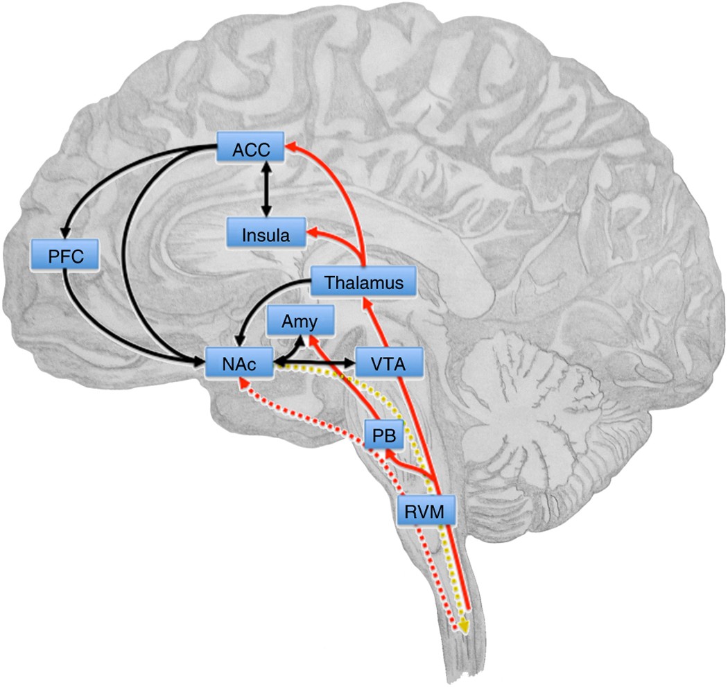 Corticostriatal circuits in the transition to chronic back pain: The  predictive role of reward learning - ScienceDirect