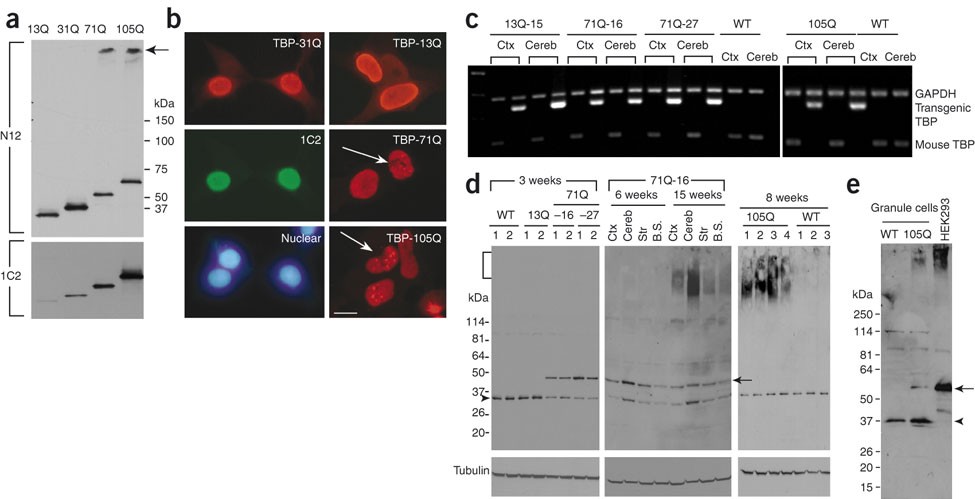 polyglutamine domain modulates the tbp tfiib interaction a student constructs a venn diagram to compare the organelles in plant and animal cells