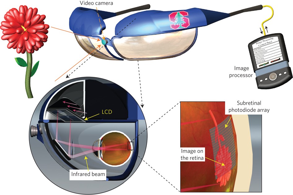 Research, Stanford Artificial Retina Project