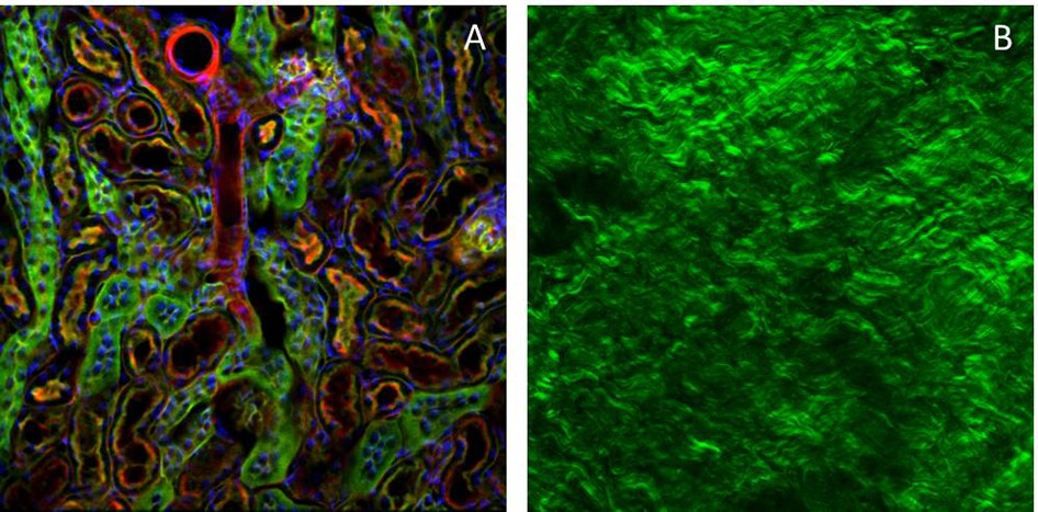 Demonstrating the results of both methods of multiphoton microscopy.