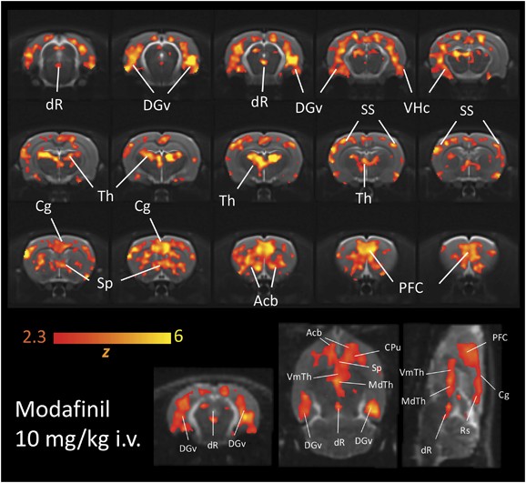 Region-Specific Effects of Nicotine on Brain Activity: A Pharmacological  MRI Study in the Drug-Naïve Rat