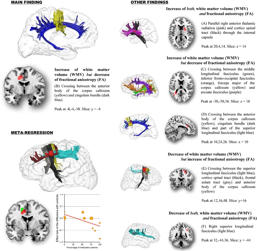 Medical Science Monitor  Biomechanical Behavior of All-on-4 and M-4  Configurations in an Atrophic Maxilla: A 3D Finite Element Method - Article  abstract #929908