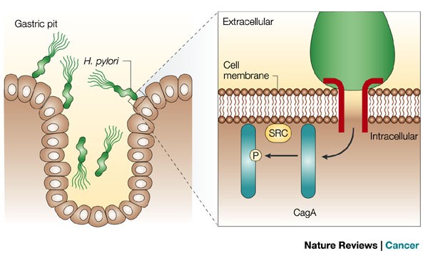 Oncogenic mechanisms of the Helicobacter pylori CagA protein | Nature  Reviews Cancer