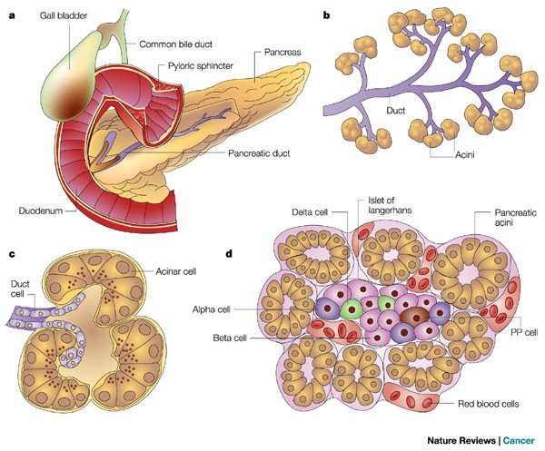 pancreatic cancer genetic heterogeneity