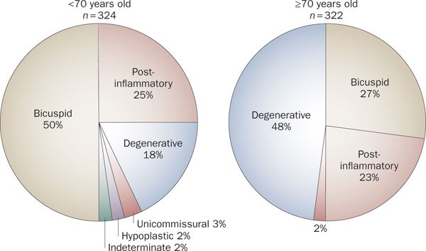 Prosthetic valve selection for middle-aged patients with aortic stenosis |  Nature Reviews Cardiology